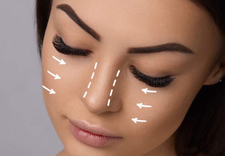 Plastic operation rhinoplasty nose