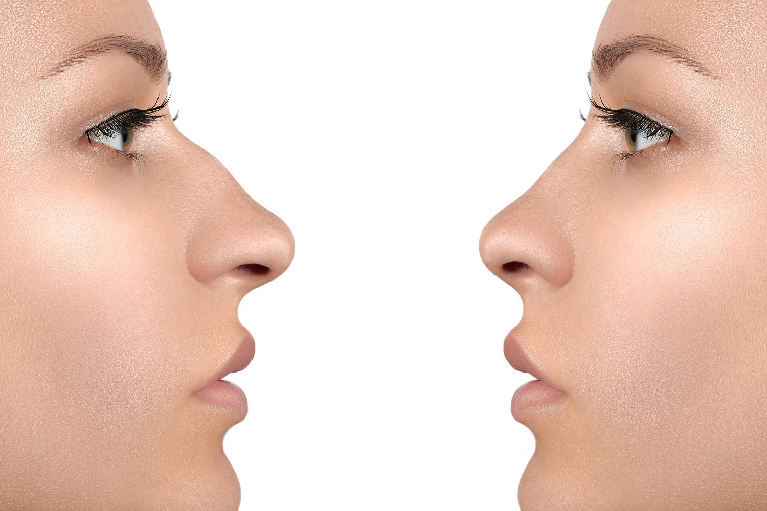 Plastic nose surgery - What is it when you need why it is worth doing it abroad?