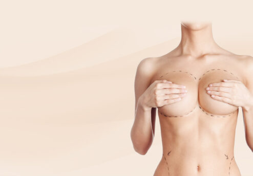Plastic breast operation
