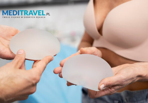 Do you need to change your breast implants?