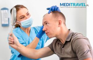Can I practice after hair transplantation in Turkey