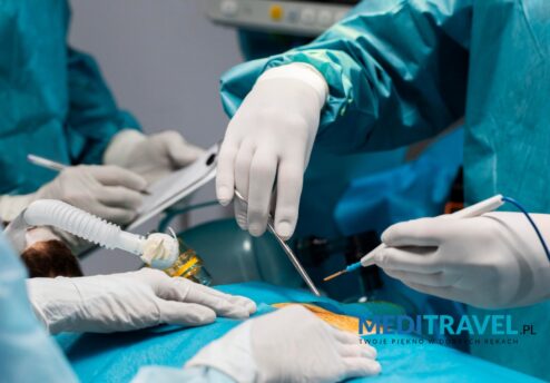 3 Myths about liposuction in Turkey
